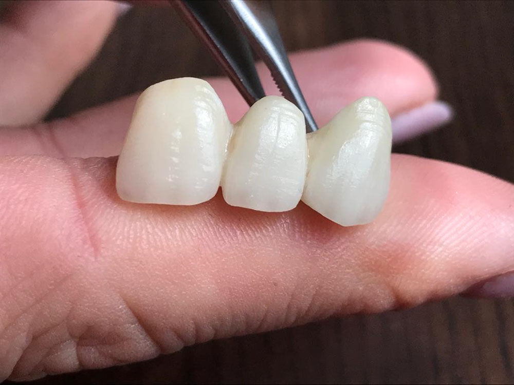 Protetyka zębów Śląsk