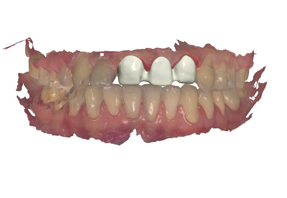 Protetyka zębów Śląsk